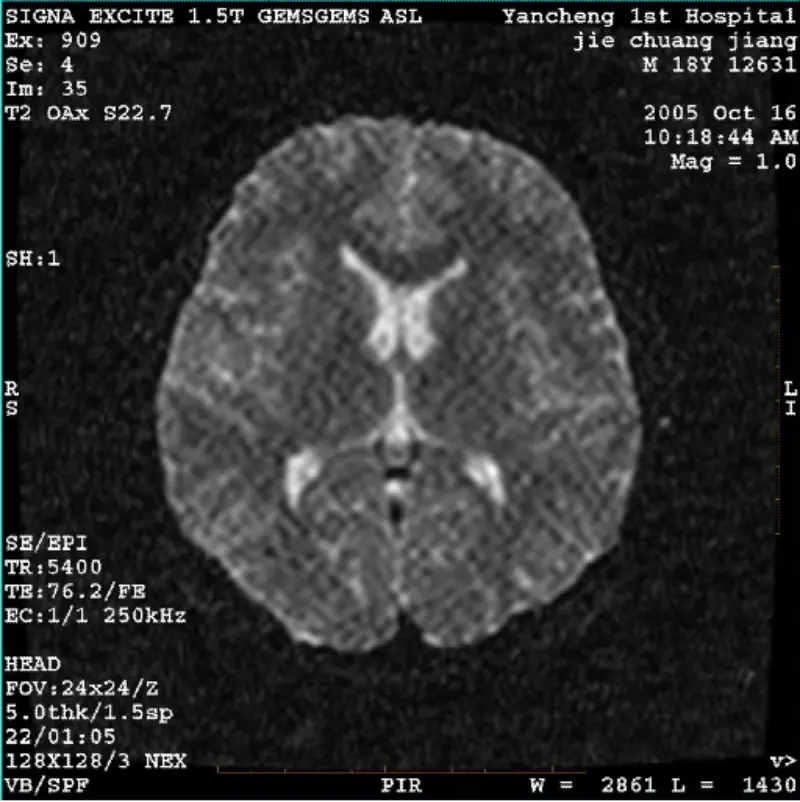 АРТЕФАКТ WI/Fiesta слика Бел пиксел